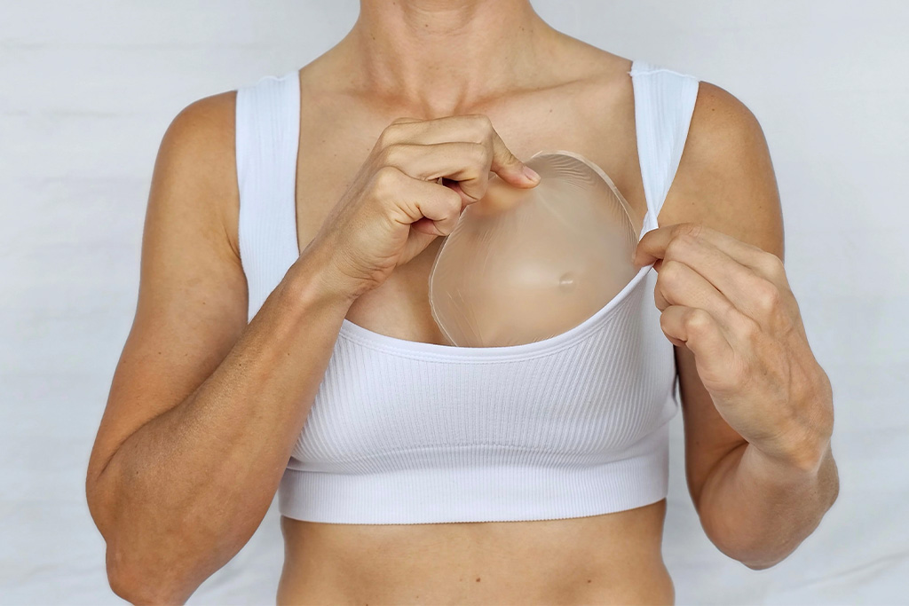 Breast Restoration-details